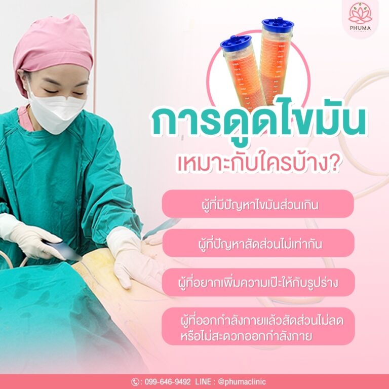 Phuma clinic (ภูม่า) พญ.ชลดา วิรัตกพันธ์ (ดูดไขมัน)