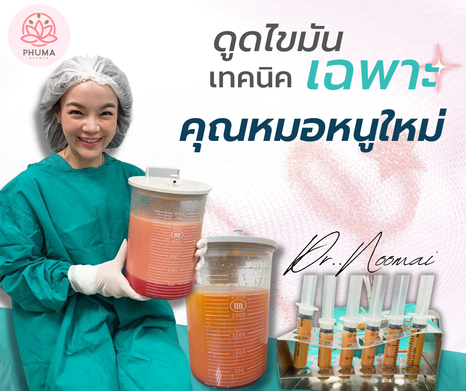 ดูดไขมัน หมอลดา (คุณหมอหนูใหม่) phuma clinic