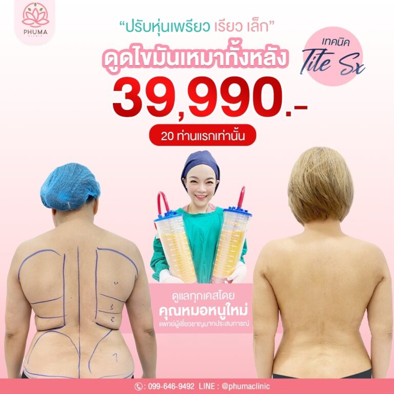 Phuma clinic (ภูม่า) พญ.ชลดา วิรัตกพันธ์ (ดูดไขมัน)