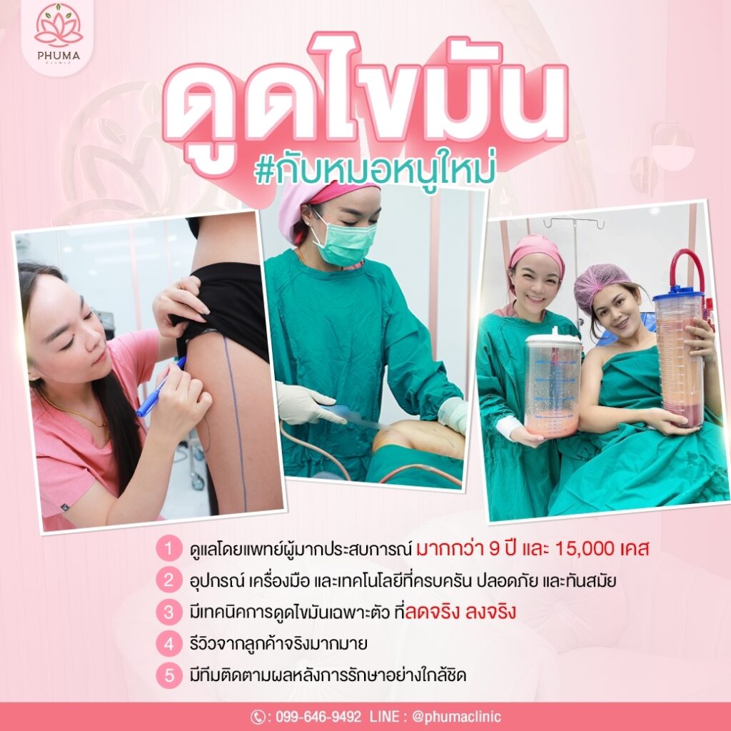 Phuma clinic (ภูม่า) พญ.ชลดา วิรัตกพันธ์ (ดูดไขมัน)