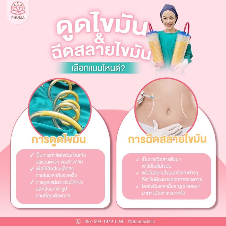 Phuma clinic (ภูม่า) พญ.ชลดา วิรัตกพันธ์ (ดูดไขมัน)