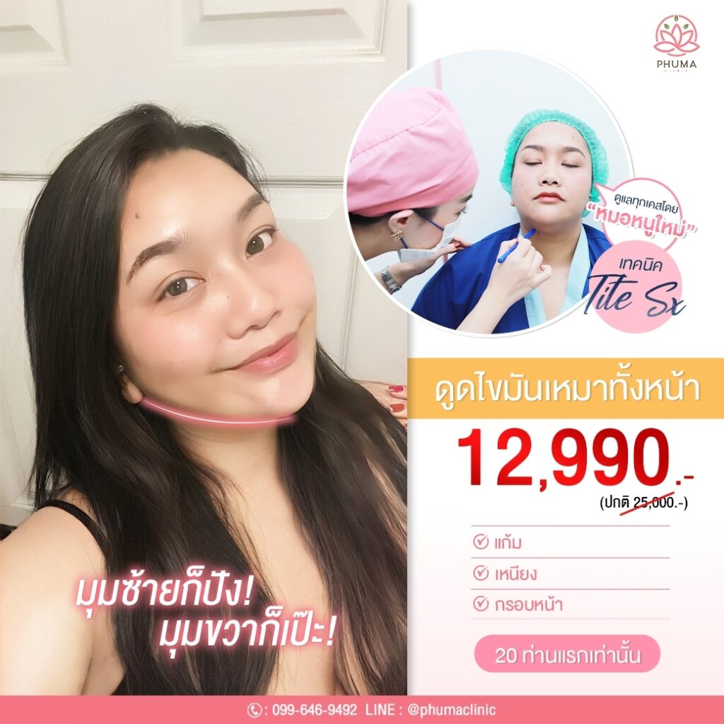 Phuma clinic (ภูม่า) พญ.ชลดา วิรัตกพันธ์ (ดูดไขมัน)