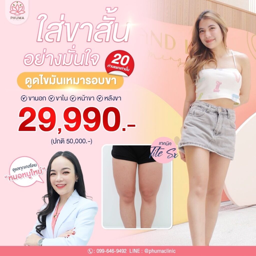 Phuma clinic (ภูม่า) พญ.ชลดา วิรัตกพันธ์ (ดูดไขมัน)