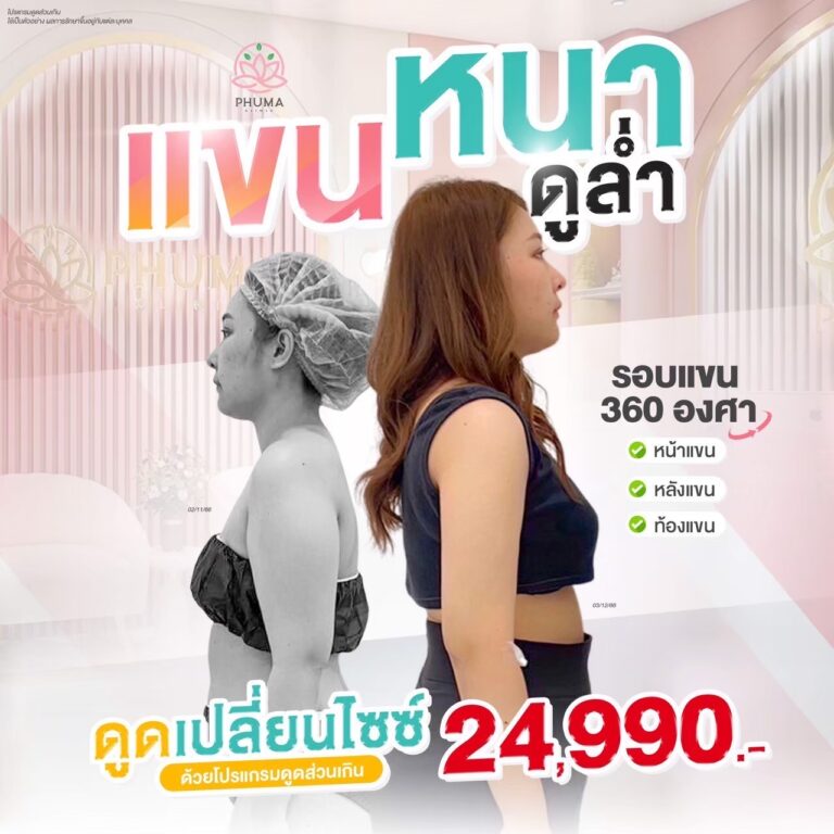 ดูดไขมัน หมอลดา (คุณหมอหนูใหม่) phuma clinic