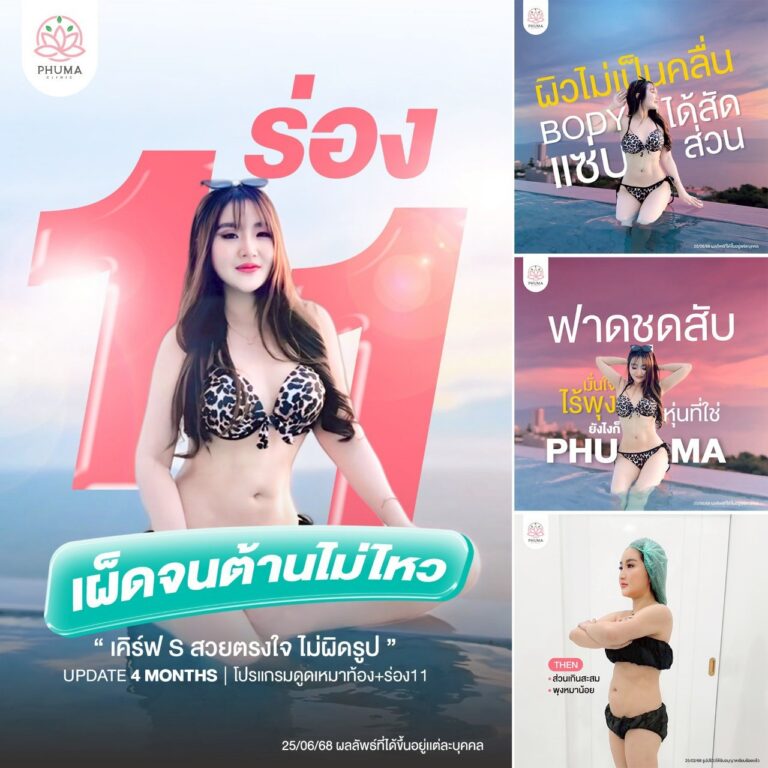 PHUMA CLINIC เป็นคลินิกที่ให้บริการ ดูดไขมัน เติมไขมันหน้า ลดสัดส่วน และปรับรูปหน้า ก่อตั้งโดย พญ.ชลดา วิรัตกพันธ์ (หมอหนูใหม่) แพทย์ผู้มีความชำนาญและมีประสบการณ์ยาวนานมากกว่า 10 ปี ประสบการณ์ทำทำเคสมามากกว่า 20,000 เคส